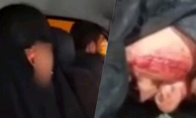 افشای اقدام عجیب متحصنین مقابل مجلس: این زن، صورت خود را دیشب پاره کرد تا بگوید فراجا با او برخورد فیزیکی کرده است