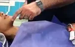 جراحی موفق فک برای دختر نوجوان سنندجی