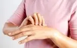 آیا واقعا می‌توانیم جلوی نیش پشه را بگیریم؟